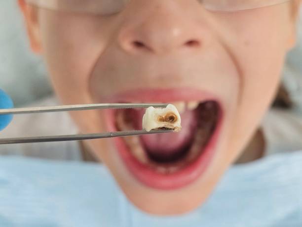 Best Holiday Emergency Dentist in Spout Springs, NC